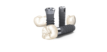 Dental Implants Decorative Image